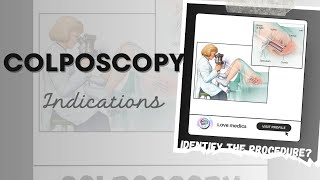 What is colposcopy  The diagnostic procedure Colposcope  Indication of colposcopy [upl. by Earvin]