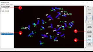 Karyotype analysis using KaryoMeasure [upl. by Myo]