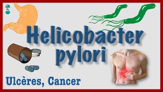 Helicobacter pylori  Physiopathologie Ulcères Diagnostic Traitement [upl. by Ondine]