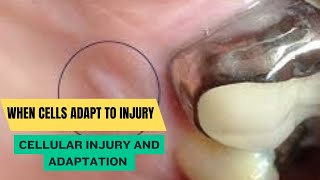 Cellular Injury and Adaptation [upl. by Comptom421]