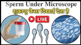 semen analysis test in hindi  Semen Test  Semen Test Report  Sperm Countsemenanalysistest semen [upl. by Bega]