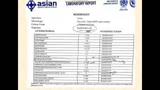 Urine culture and sensitivity test urineculturetest and sensitivitytest urinalysis [upl. by Bois]