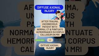 Diffuse axonal injury [upl. by Adamek]