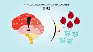 HypoxicIschemic Encephalopathy About Treatments amp Causes [upl. by Arondel428]