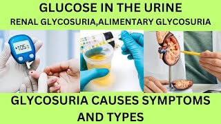 GLUCOSESUGAR IN THE URINE TESTTYPES AND CAUSES OF GLYCOSURIARENALALIMENTERY GLYCOSURIA [upl. by Lombardy991]