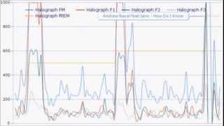 Effects of Choline and Galantamine on Eye Movements During Sleep [upl. by Durkin]