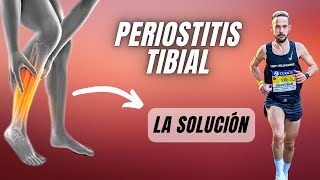 ❌ Descubre Cómo ELIMINAR la PERIOSTITIS TIBIAL FUNCIONA ✅ [upl. by Akcebar]