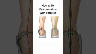 How to fix overpronation with exercise⚠️ exerciseroutine overpronation sports motivation [upl. by Gally]