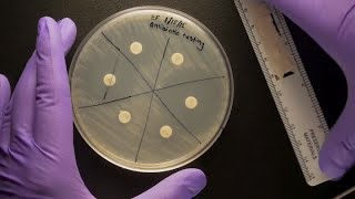 ID Laboratory Videos Antibiotic susceptibility testing [upl. by Nyrol718]