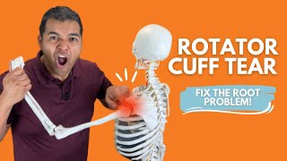 Rotator Cuff Tear Everything You Need To Know To Understand amp Fix The Root Problem [upl. by Daffodil727]