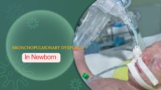 BRONCHOPULMONARY DYSPLASIA CHRONIC LUNG DISEASE  DEFINATION DR MEENA CHOUDHARY [upl. by Holmes]