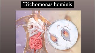 Trichomonas hominis [upl. by Jemma]