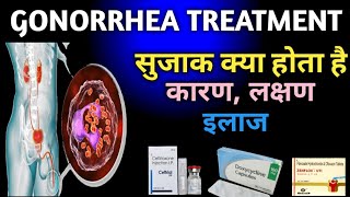 Gonorrhea Treatment  सुजाक का इलाज   how to treat gonorrhea SNPharmacy [upl. by Nnylarac]