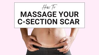 How to Massage Your CSection Scar [upl. by Ailuig]