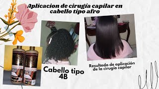 Aplicación de cirugía capilar paso a paso en cabello afro 4B [upl. by Cline]