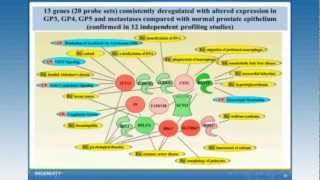 How IPA Can Help Explore Potential Biomarkers for a Complex Disease [upl. by Kung]