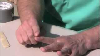 How to Splint Different Finger Injuries [upl. by Acihsay]