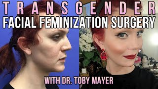 Transgender Facial Feminization Surgery Before And After  Dr Toby Mayer [upl. by Mohandas]