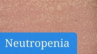 Neutropenia qué es qué la causa tratamientos disponibles y medidas para prevenir las infecciones [upl. by Dewey]