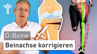 Umstellungsosteotomie Knie OBeine durch OP korrigieren [upl. by Nadeen]