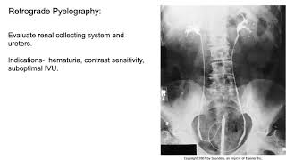 Radiology of the Urogenital system [upl. by Day975]