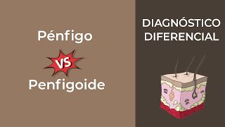 Diagnóstico Diferencial Pénfigo vs Penfigoide [upl. by Hiroshi]