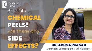 Chemical Peels For Acne Scar  Side Effects Of Chemical Peels skin DrAruna PrasadDoctors Circle [upl. by Anotyal]