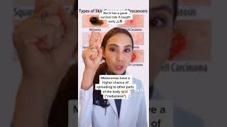 Types of skin cancers Part 1  Dr Mamina [upl. by Clarisse]