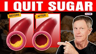 How Quitting Sugar Reversed My Arterial Plaque [upl. by Ogawa]