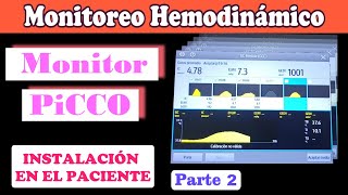 MONITOREO HEMODINAMICO  SISTEMA PICCO  COLOCACIÓN EN EL PACIENTE PARTE 23 [upl. by Hgielrak]