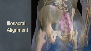 Iliosacral Alignment Technique to Level the Sacral Base [upl. by Nonnag]