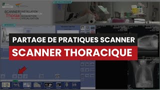 CT Scanner THORACIQUE Sans Injection  Partage de Pratiques [upl. by Eivets]