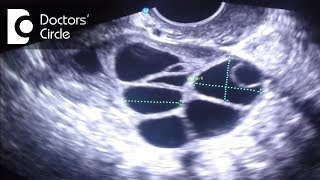 What do follicle size change in follicular study scan signify  Dr Teena S Thomas [upl. by Sulecram]