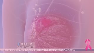 Cáncer de mama en México [upl. by Picker]