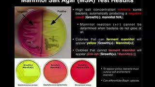 Mannitol Salt Agar MSA  Results amp Theory [upl. by Eyram]