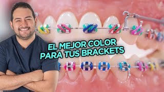 EL MEJOR y PEOR COLOR DE LIGAS PARA TÚ TRATAMIENTO DE BRACKETS  COMBINACIONES DE COLORES ORTODONCIA [upl. by Eiramassenav480]