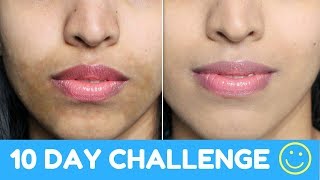 How To Get Even Skin Tone Naturally Powerful Home Remedy Hyper Pigmentation [upl. by Faydra]