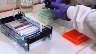 How to run an agarose gel [upl. by Dolph753]