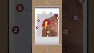 The 12 most common pain locations in the shoulder [upl. by Atinnor953]