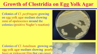 محاضرة الكلوستريديوم الجزء الاول Clostridia Lecture Part I [upl. by Raddie]