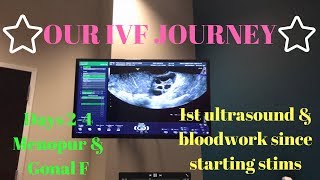 IVF injections days 24 and first ultrasound to check follicles [upl. by Tombaugh]