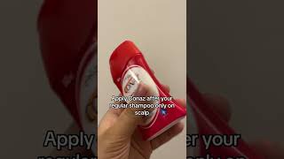 Conaz Shampoo Based Scalp Lotion  Conaz Lotion  Review  Anti Dandruff  Itchy Scalp Treatment [upl. by Nyleuqaj74]