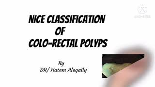 NICE POLYP CLASSIFICATION [upl. by Baudelaire345]