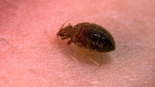 A Bedbugs Bite  Up Close  Bang Goes the Theory  BBC [upl. by Lienahs972]