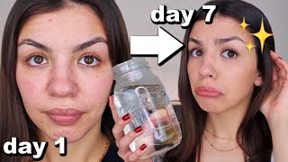 I Drank A Gallon Of Water A Day For One Week  Before And After Results [upl. by Symon983]