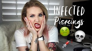 IS MY PIERCING INFECTED  Signs Of An Infected Piercing [upl. by Jonna]