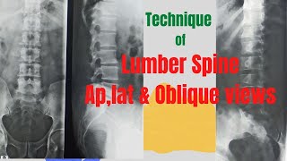 Technique of L Spine Ap  Lat amp Oblique views Ep63 Xray lumber spine views [upl. by Akeimat]