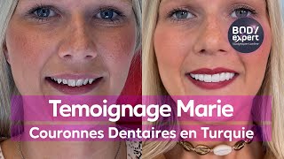 SOINS DENTAIRES  🦷 Témoignage Marie  20 couronnes dentaires Emax  BODYEXPERT [upl. by Holder]