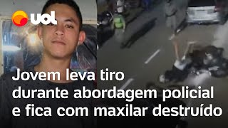 Jovem de 19 anos leva tiro em abordagem policial em Caldas Novas Maxilar destruído veja vídeo [upl. by Annaeel558]