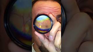 How to Do Your Own Fundus Exam [upl. by Ainirtak]